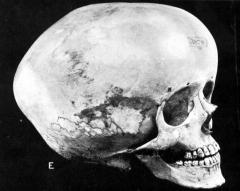 宇宙人の頭骨が発見された!? メキシコの「スターチャイルド」